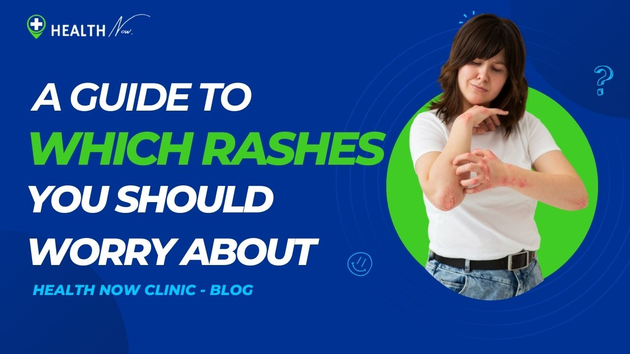 A Guide to Which Rashes You Should Worry About